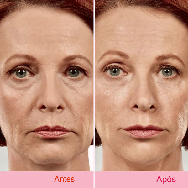 Fita adesiva para lifting facial invisível V-Face Anti Rugas