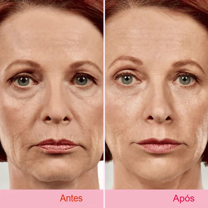 Cinta Adhesiva Invisible para Lifting Facial V-Face Antiarrugas