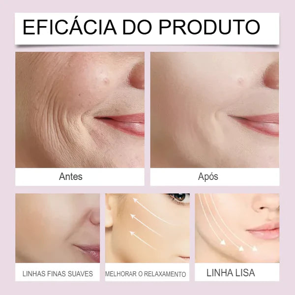Fita adesiva para lifting facial invisível V-Face Anti Rugas