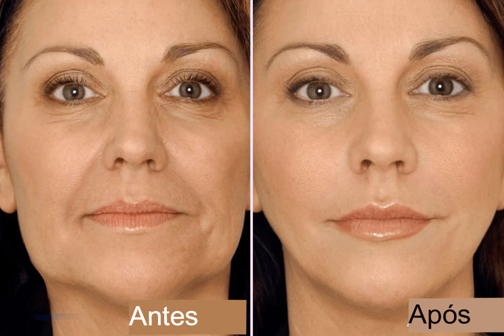Fita adesiva para lifting facial invisível V-Face Anti Rugas